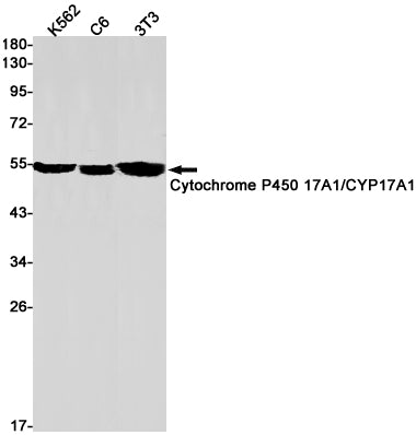 Cytochrome P450 17A1 (6C2) Rabbit Monoclonal Antibody
