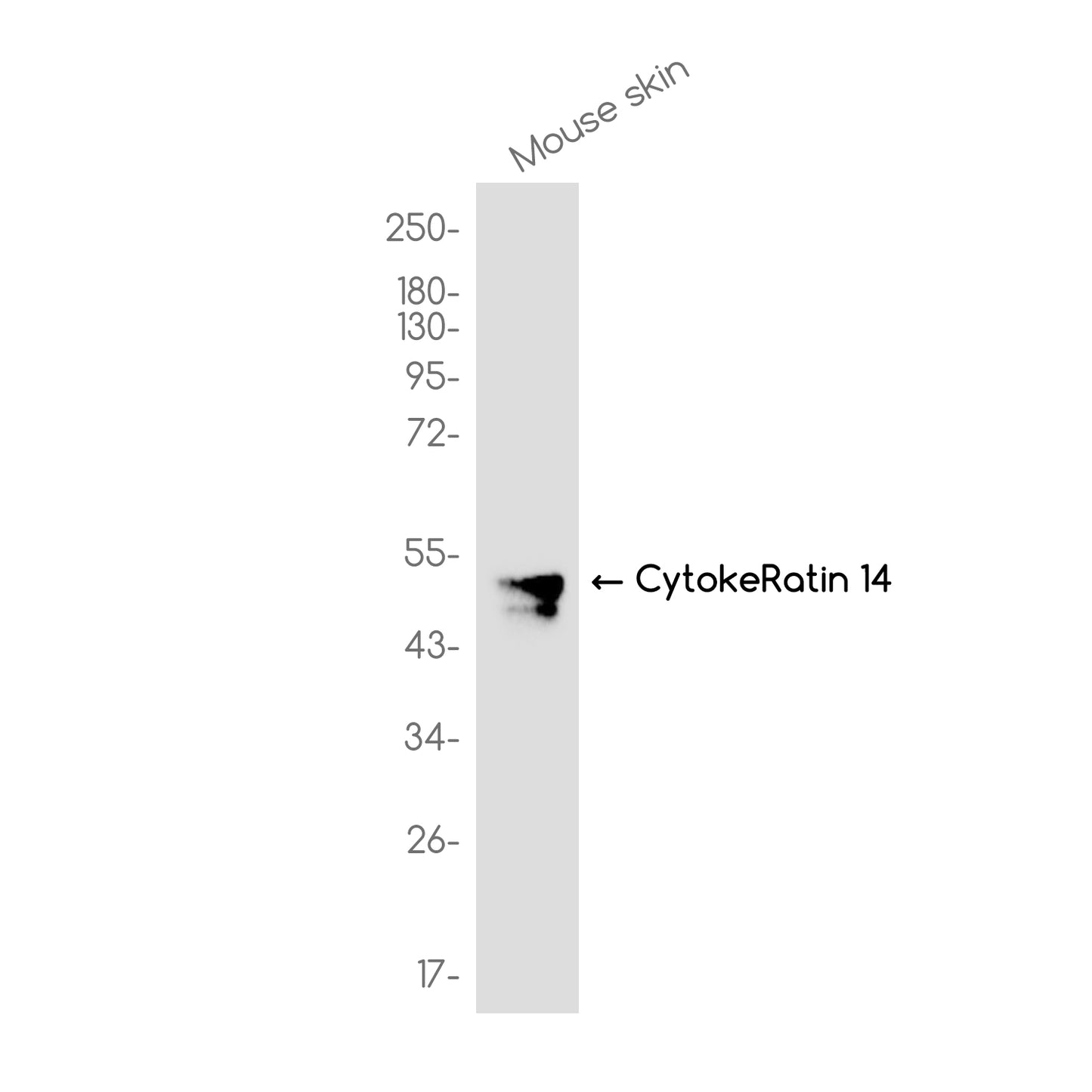 Cytokeratin 14 (12Q6) Rabbit Monoclonal Antibody