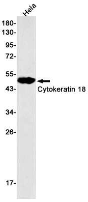 Cytokeratin 18 (8W18) Rabbit Monoclonal Antibody