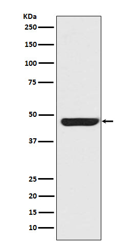Cytokeratin 20 (8W19) Rabbit Monoclonal Antibody