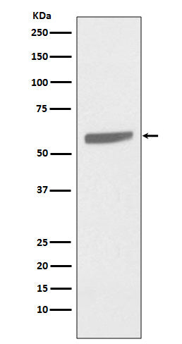 Cytokeratin 5 (18R6) Rabbit Monoclonal Antibody