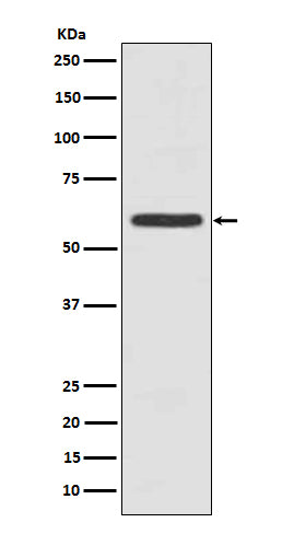 Cytokeratin 5 (C-term) (15B6) Rabbit Monoclonal Antibody