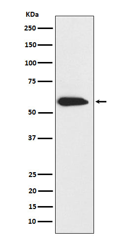 Cytokeratin 6 (9I15) Rabbit Monoclonal Antibody