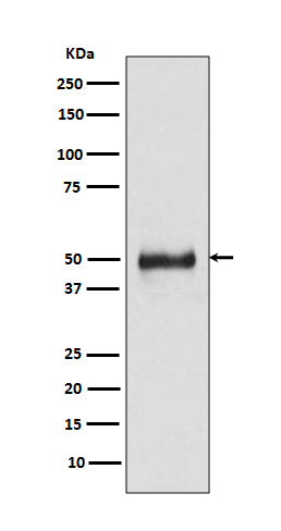 Cytokeratin 8 (3B5) Rabbit Monoclonal Antibody