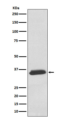 delta Sarcoglycan (10R2) Rabbit Monoclonal Antibody