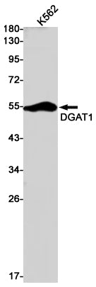 DGAT1 (12C4) Rabbit Monoclonal Antibody