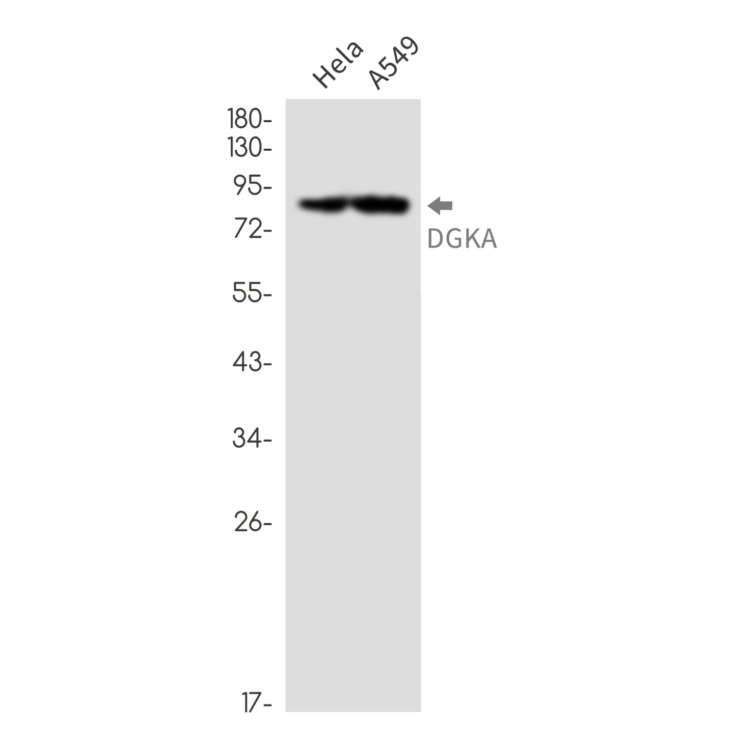 DGKA (5X13) Rabbit Monoclonal Antibody