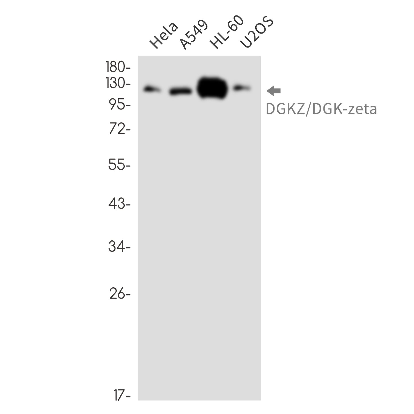 DGKZ (16X2) Rabbit Monoclonal Antibody