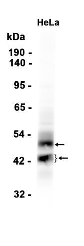 DR5 (3Q11) Rabbit Monoclonal Antibody