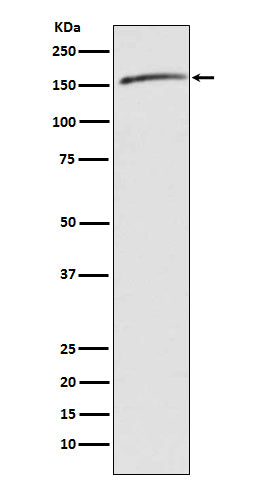 Drosha (18P9) Rabbit Monoclonal Antibody