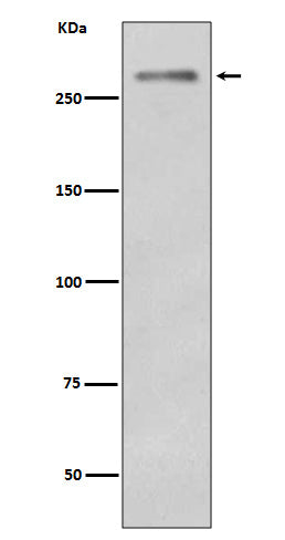 Dysferlin (19Q14) Rabbit Monoclonal Antibody