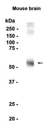 EAAT1 (14Y4) Rabbit Monoclonal Antibody