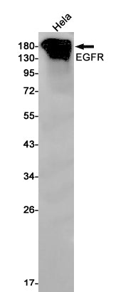 EGFR (14A15) Rabbit Monoclonal Antibody