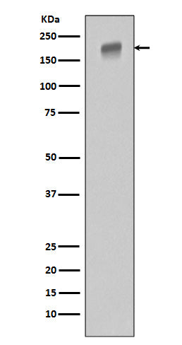 EGFR (ErbB 1) (9C2) Rabbit Monoclonal Antibody