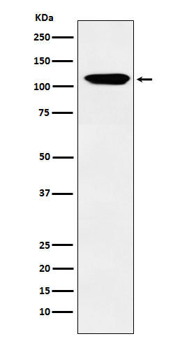 Eph receptor B3 (8N7) Rabbit Monoclonal Antibody