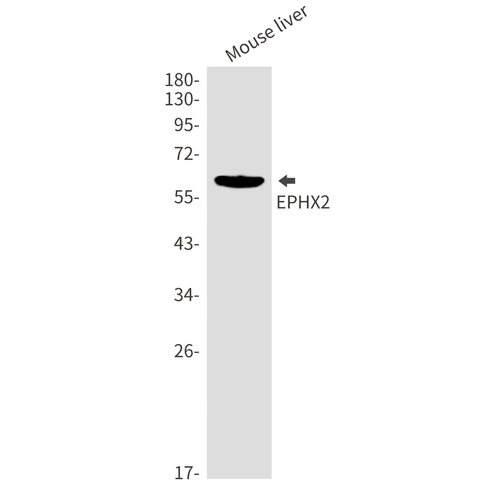 EPHX2 (4Q4) Rabbit Monoclonal Antibody