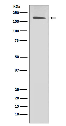 ErbB2 (HER2) (4J7) Rabbit Monoclonal Antibody