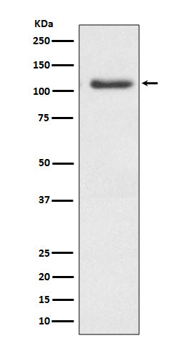 ERK5 (1Z9) Rabbit Monoclonal Antibody