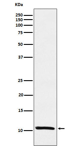 Estrogen Inducible Protein pS2 (5F16) Rabbit Monoclonal Antibody