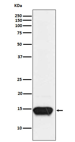 FABP3 (8Z18) Rabbit Monoclonal Antibody