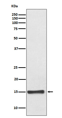 FABP4 (8A13) Rabbit Monoclonal Antibody