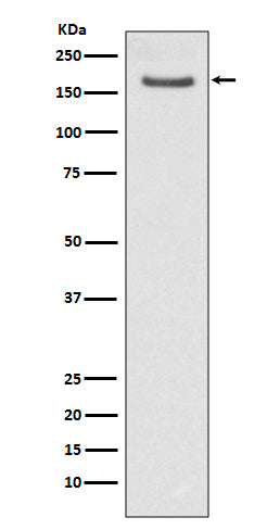 FANCD2 (16Q3) Rabbit Monoclonal Antibody