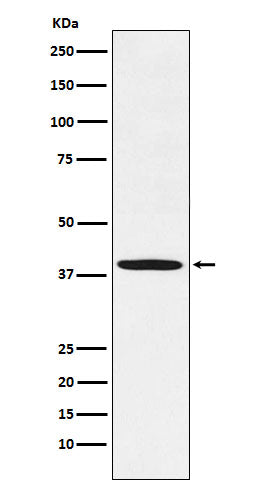 Fbx32 (2X3) Rabbit Monoclonal Antibody