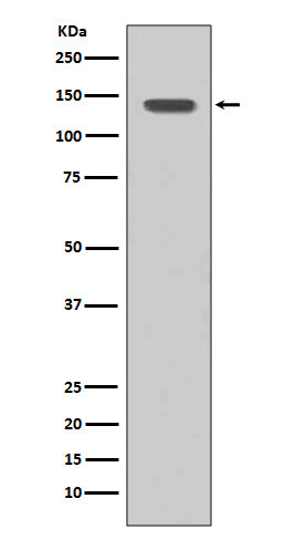 FGFR1 (1X7) Rabbit Monoclonal Antibody