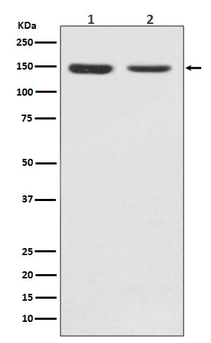 FGFR2 (18K11) Rabbit Monoclonal Antibody