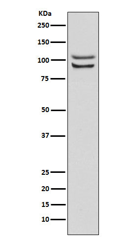 FGFR4 (11K9) Rabbit Monoclonal Antibody