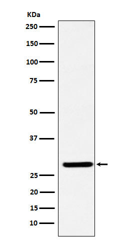FHL2 (4I16) Rabbit Monoclonal Antibody
