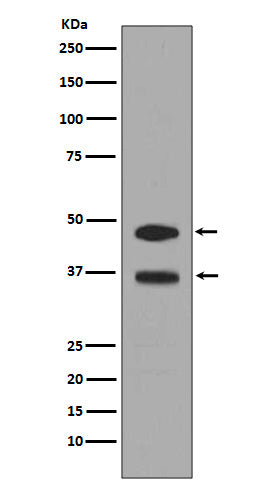 Fos B (18J10) Rabbit Monoclonal Antibody