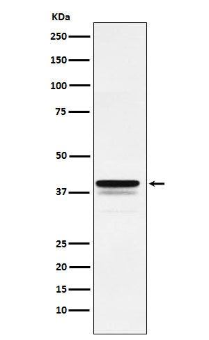 FOXF1 (8B18) Rabbit Monoclonal Antibody