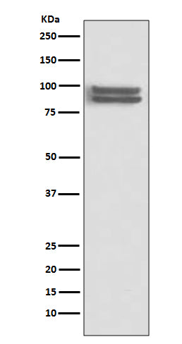FOXP1 (18T18) Rabbit Monoclonal Antibody