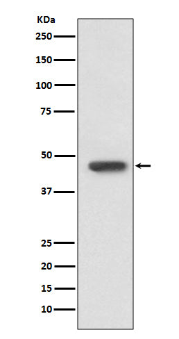 FOXP3 (1G2) Rabbit Monoclonal Antibody