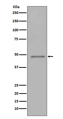 FOXP3 (5I4) Rabbit Monoclonal Antibody