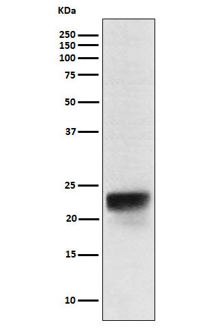 FSH beta (5T6) Rabbit Monoclonal Antibody