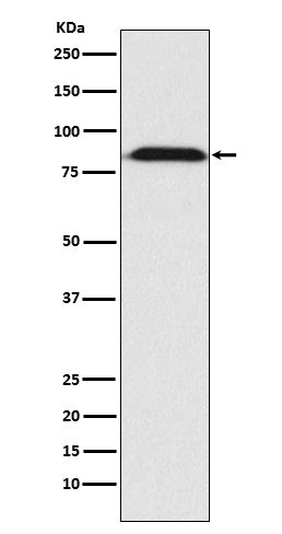 Furin (6Z15) Rabbit Monoclonal Antibody