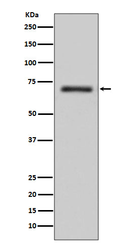FUS / TLS (18I13) Rabbit Monoclonal Antibody
