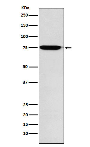 GAA (14G16) Rabbit Monoclonal Antibody