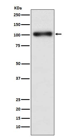 GABA B Receptor 1 (17L17) Rabbit Monoclonal Antibody