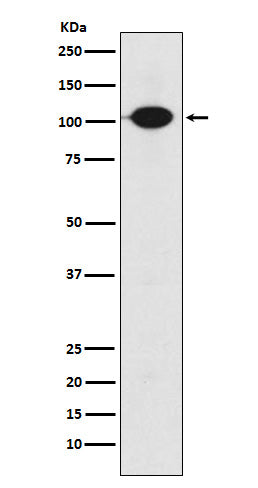 GABA B Receptor 2 (8E15) Rabbit Monoclonal Antibody