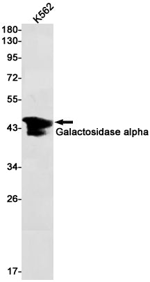 Galactosidase alpha (4R19) Rabbit Monoclonal Antibody