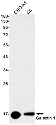 Galectin 1 (5D19) Rabbit Monoclonal Antibody