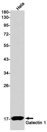 Galectin 1(18A15) Rabbit Monoclonal Antibody