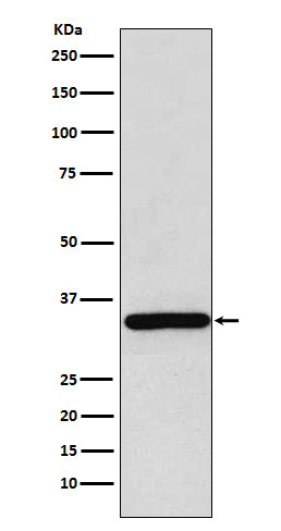 gamma Sarcoglycan (19U4) Rabbit Monoclonal Antibody