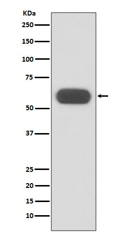 GBA (1P9) Rabbit Monoclonal Antibody