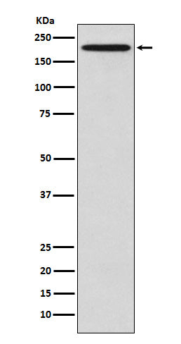 GCN2 (18S7) Rabbit Monoclonal Antibody