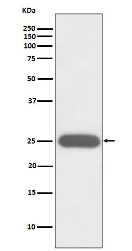G-CSF (11N11) Rabbit Monoclonal Antibody