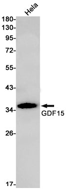 GDF15 (6F3) Rabbit Monoclonal Antibody